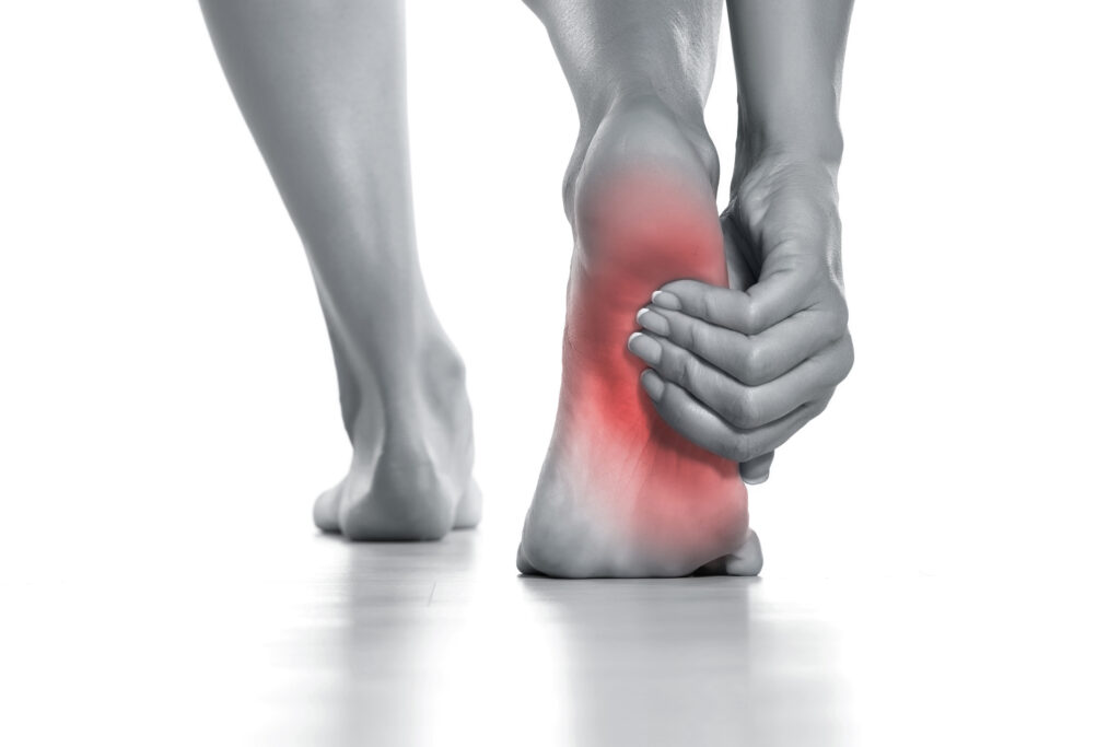 Summit Physical Therapy Helps You Avoid Plantar Fasciitis